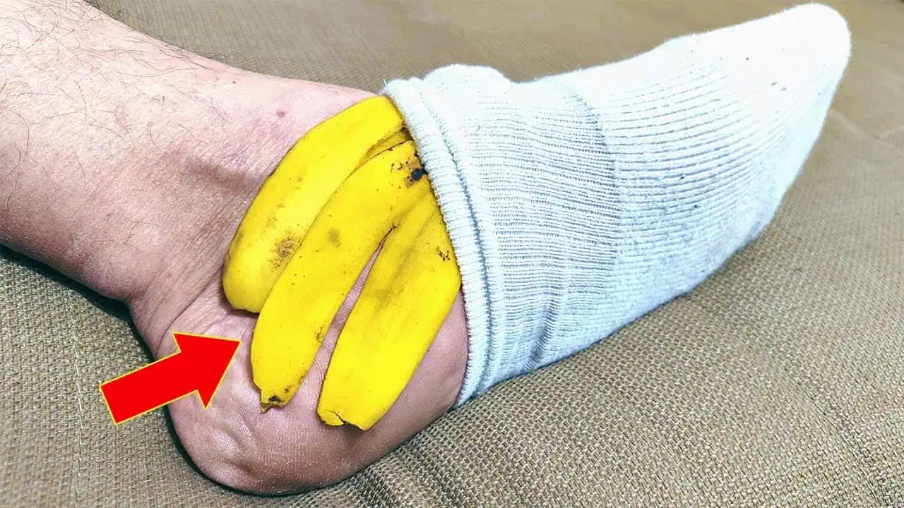 NIKDY nevyhadzuje banánovú šupku: Toto dokáže, ak si ju priložíte na nohu!