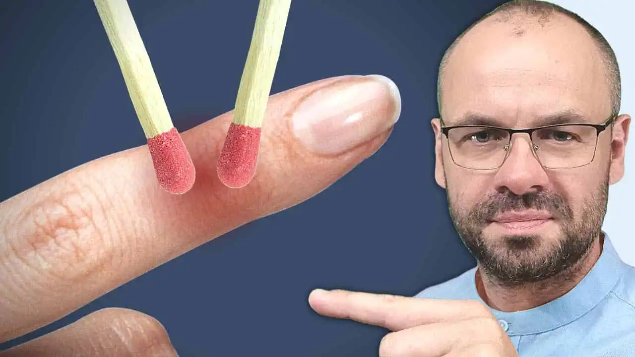 Takto zistíte, že vám v tele chýba dôležitý VITAMÍN: Potrebujete 2 ZÁPALKY!