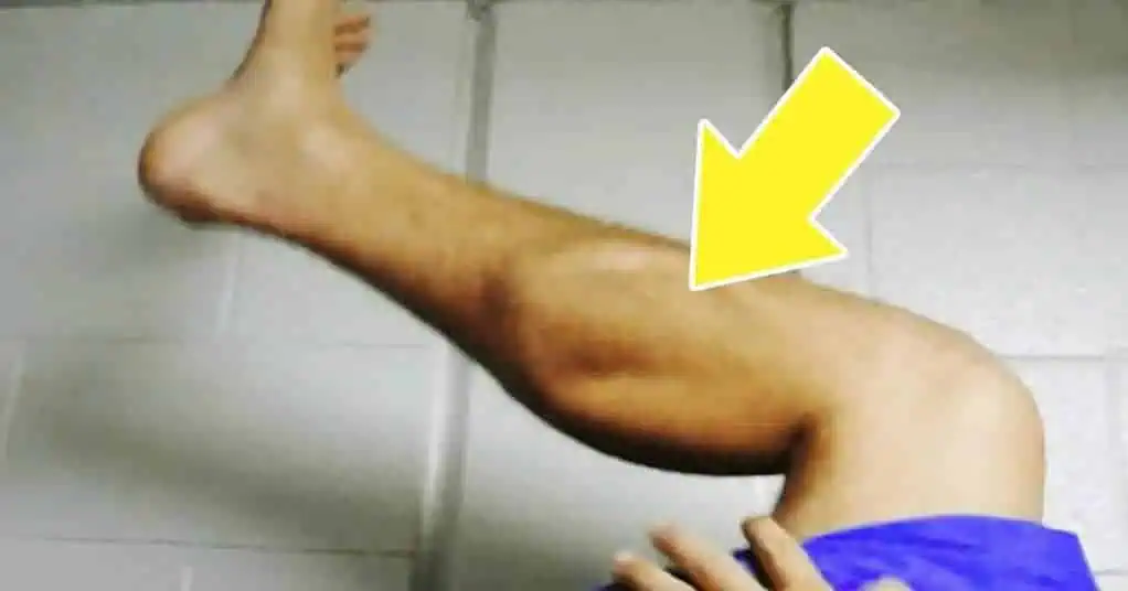 Toto by mal vedieť každý, koho trápi bolesť a zvlášť KŔČE v nohách: Musíte skúsiť, čo dokáže tento domáci RECEPT!